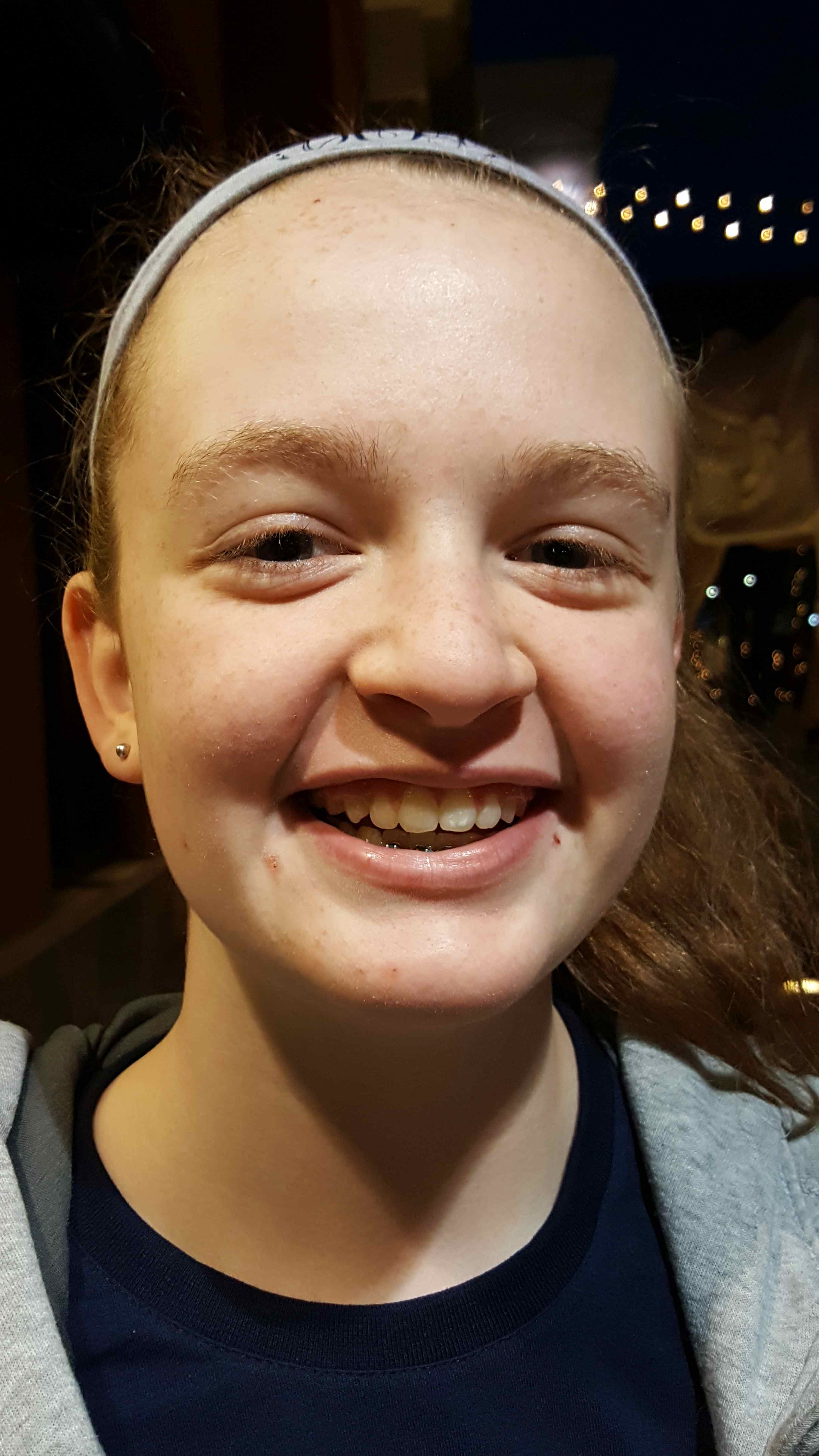 2016-12-28 Janes first picture without braces.jpg